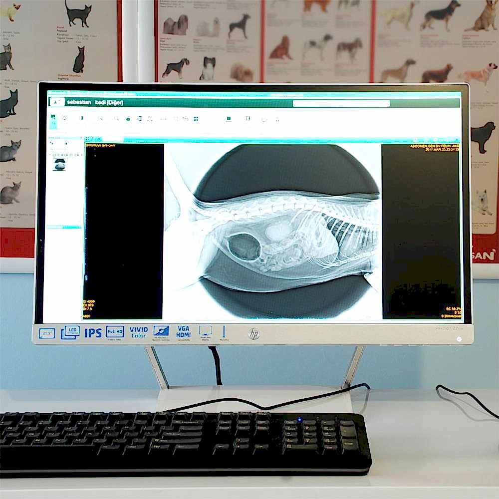 Bilgisayarlı Röntgen (CR)