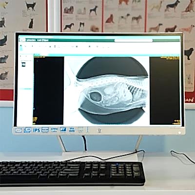 Bilgisayarlı Röntgen (CR)