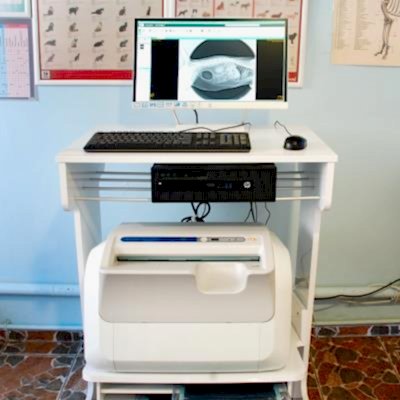 Bilgisayarlı Röntgen (CR)