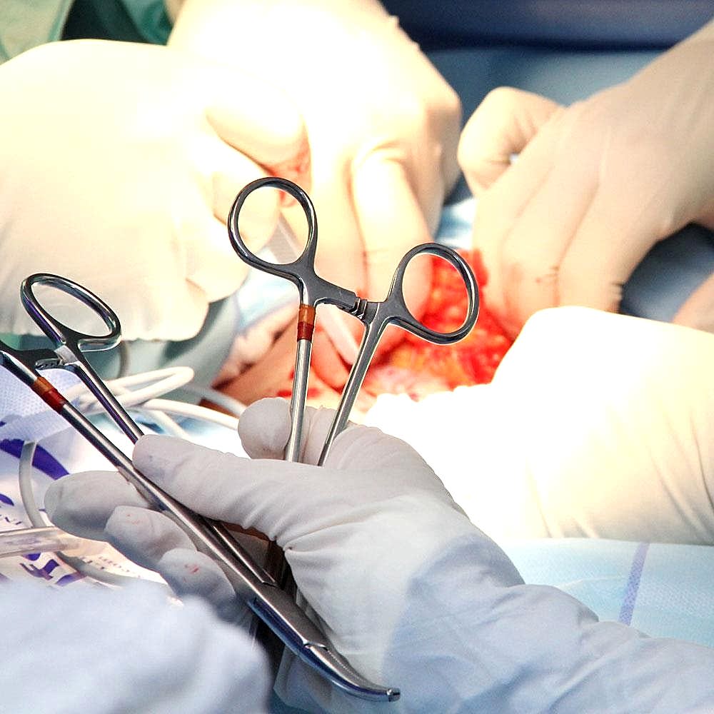 Cerrahi Operasyonlar