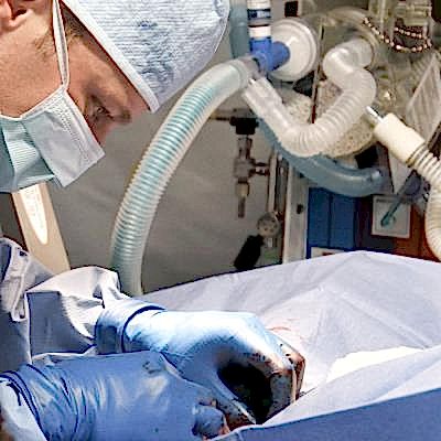 Cerrahi Operasyonlar