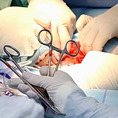 Cerrahi Operasyonlar